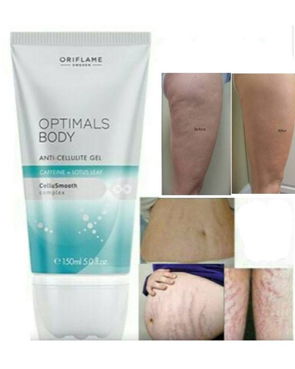 ژل آنتی سلولیت اپتیمالز بادی 31317