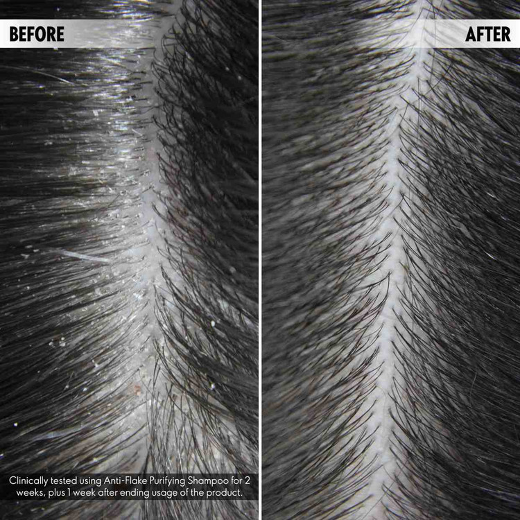 شامپو ضد شوره دولوجی - 44951