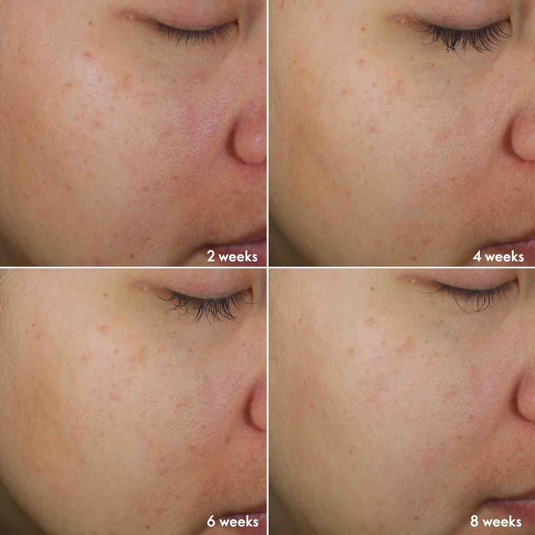 سری جدید ست محصولات ضد لک و روشن کننده نوایج پلاس 45595.