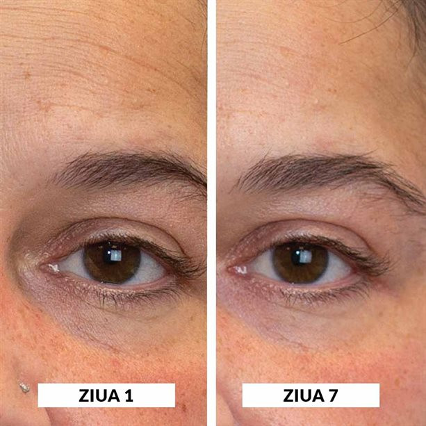 کرم ضدچروک بازسازی کننده پوست پروتینول پاور و نیاسینامید آنیو آونAvon