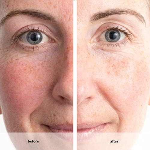 سرم پاور جوانساز کننده و بازسازی کننده پوست آون _ ۳۰میل