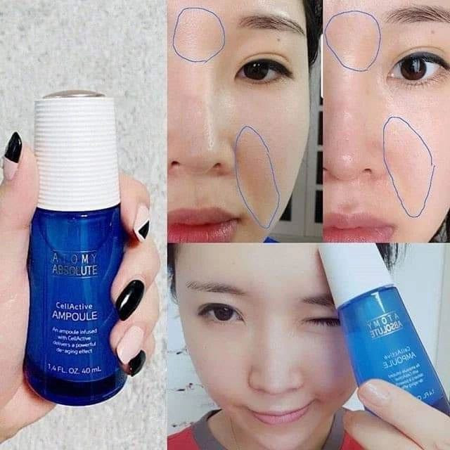 آمپول( سرم) درمانی کلاژن ساز ، ضدچروک و ضدپیری اتمی _ ۴۰میل